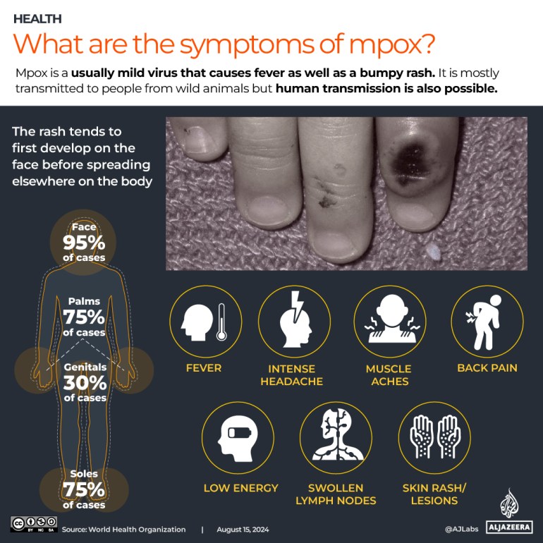 INTERACTIVE_MPOX 19 أغسطس 2024_العلامات والأعراض منقحة