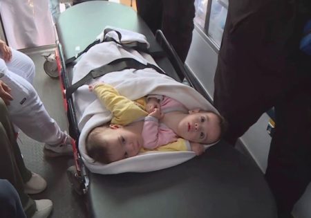 وصول التوأمين السياميين السوريين “سيلين وإيلين” إلى الرياض