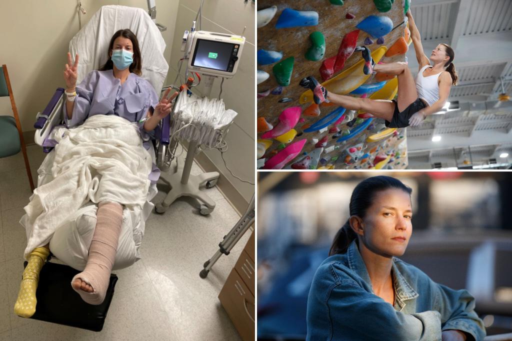 كدت أن أموت وأنا أسقط من ارتفاع 200 قدم أسفل منحدر جليدي – اعتقدت أنني لن أتمكن من المشي مرة أخرى أبدًا ولكنني عدت الآن إلى تسلق الصخور