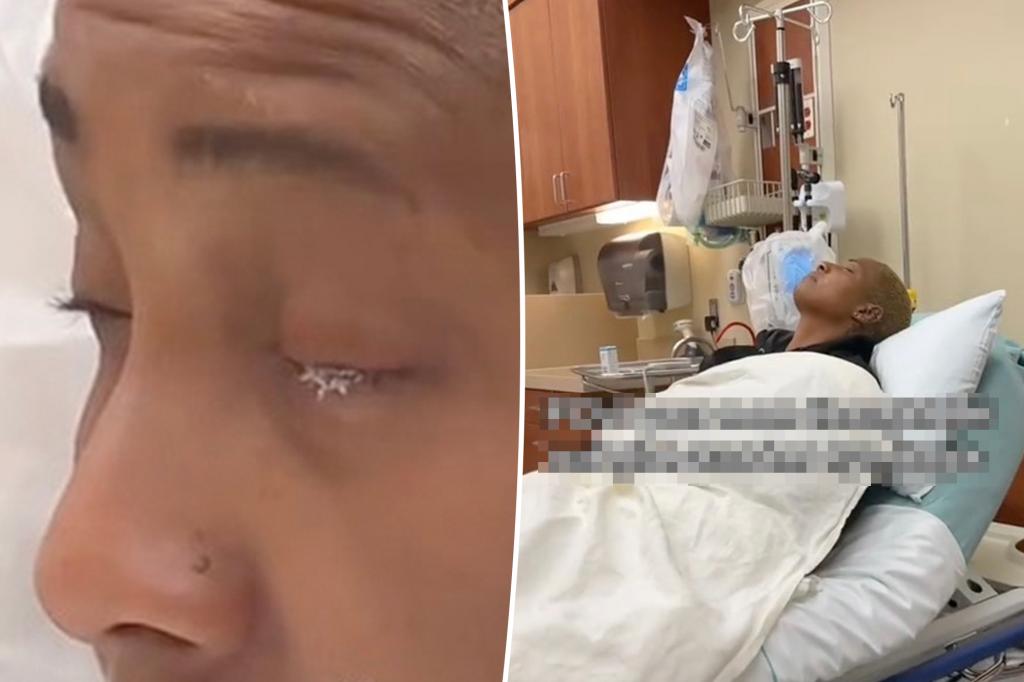 أم من كارولاينا الشمالية تخطئ في غراء الأظافر وتظنه قطرة للعين، وتتحمل شهرين من “الجحيم”