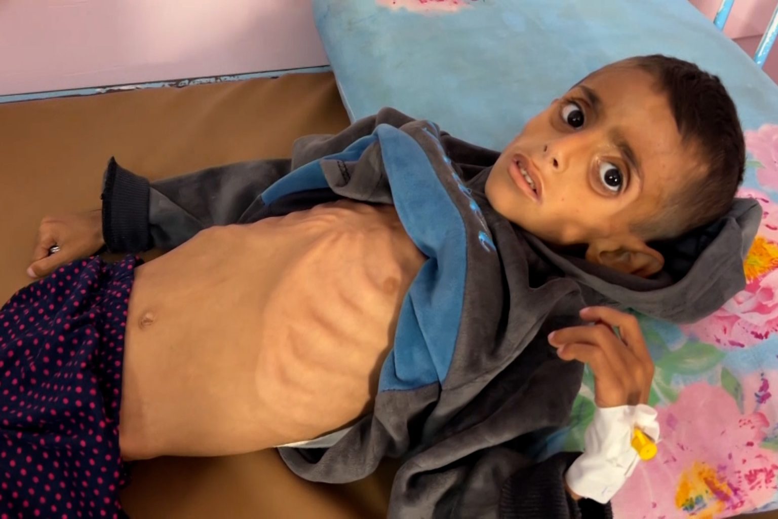 “غزة تموت جوعا” وسم يتصدر منصات التواصل