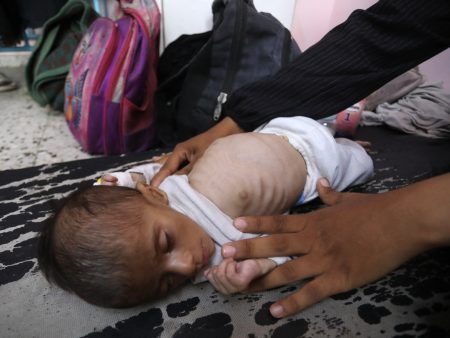 115 شهيدا.. التجويع يواصل الفتك بالفلسطينيين في غزة