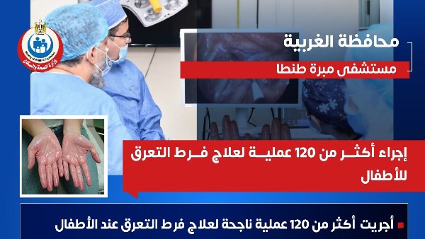 إجراء 120 عملية لعلاج فرط التعرق للأطفال في مبرة طنطا