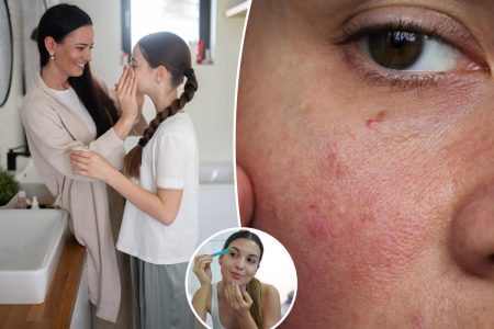 يطور المراهقون مشكلات مدى الحياة بسبب إجراءات العناية بالبشرة