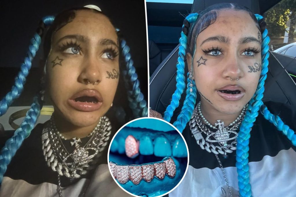 أطباء الأسنان يحذرون من انتشار تيك توك