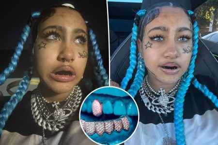 أطباء الأسنان يحذرون من انتشار تيك توك