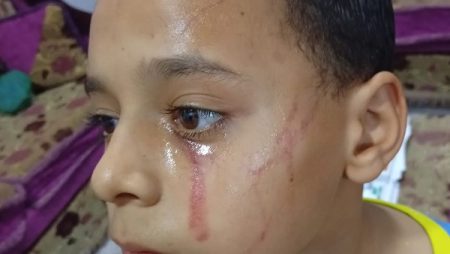 4 طلاب يعتدون على زميلهم بمدرسة ببني سويف.. ووالده يستغيث بوزير التعليم