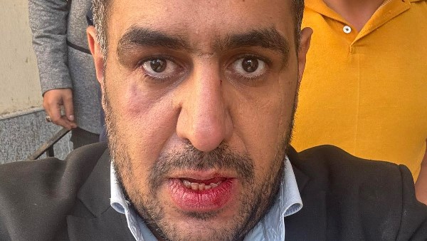 قطّعوا له هدومه | أحمد عبدربه: تعرّضت للضرب أمام محكمة طنطا لمنعي من الحصول على رقم 1 بالكشف