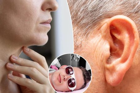 أماكن نمو الشعر غير المعتادة في الأربعينيات والخمسينيات وطرق إزالته.