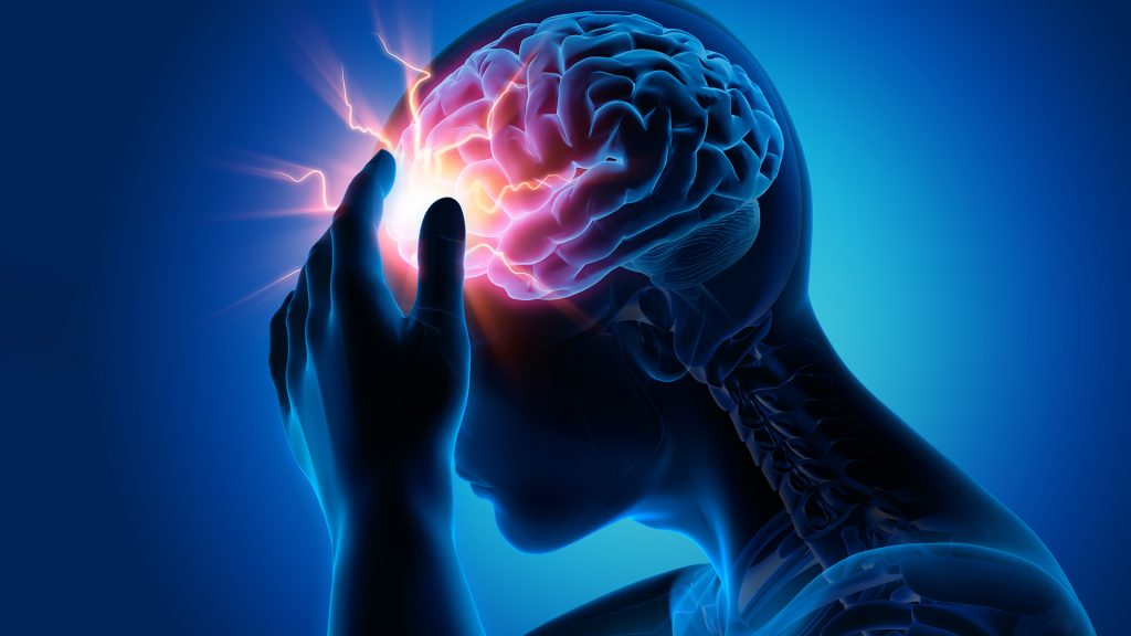 ماذا تفعل إذا شهدت نوبة صرع؟