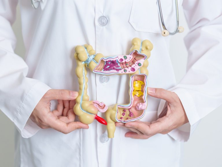 أنواع القولون العصبي وأحدث طرق التشخيص والعلاج