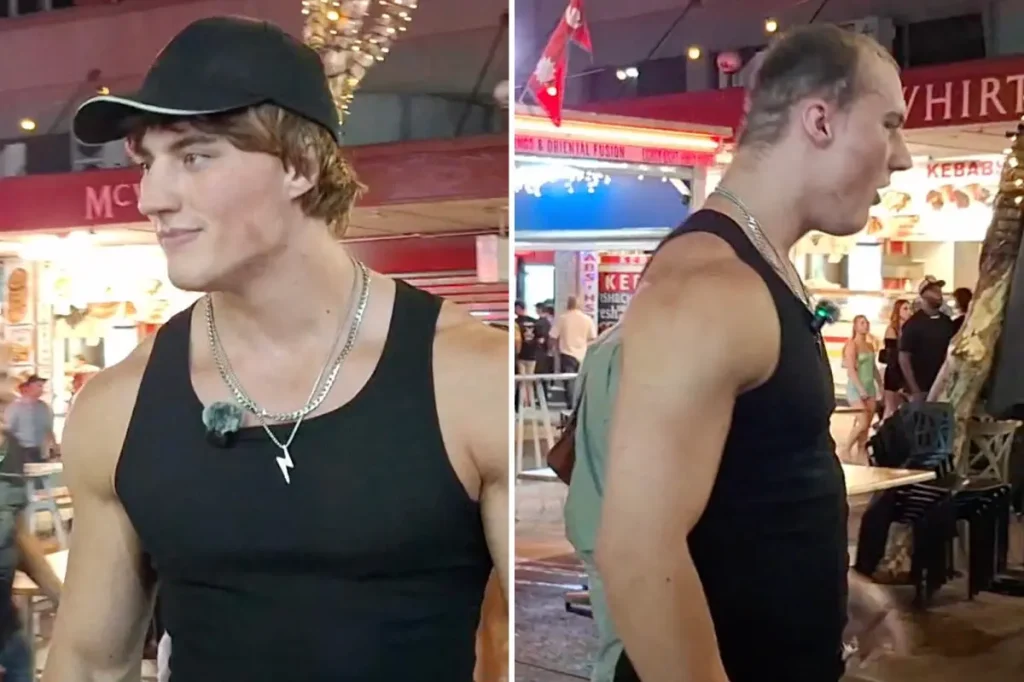 شعر مؤثر “أندروجينيك” يُنتزع من رأسه