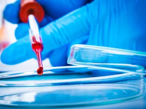 اختبار دم واحد يكشف عشرات السرطانات مبكرا